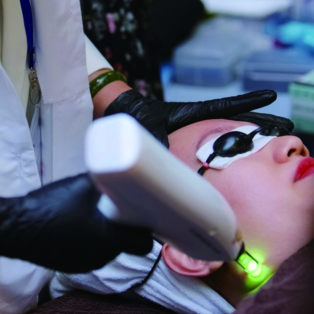 q-switch skin rejuvenation