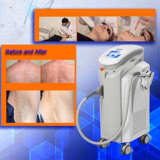 808nm 3 Wave Device Diode Laser Hair Removal Machine