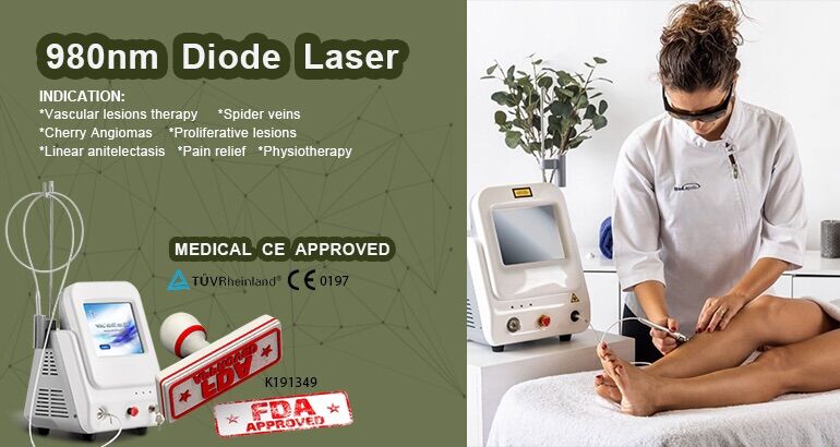 980nm diode laser vascular removal device