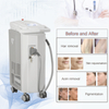 Long Pulse Professional Multiplatform Fractional Laser