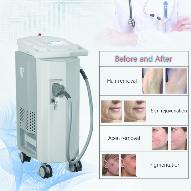 Long Pulse Professional Multiplatform Fractional Laser