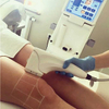 Multi-lines HIFU HS-511