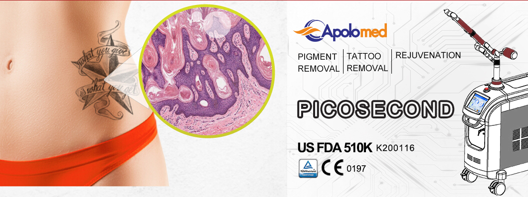 HS-298 pico