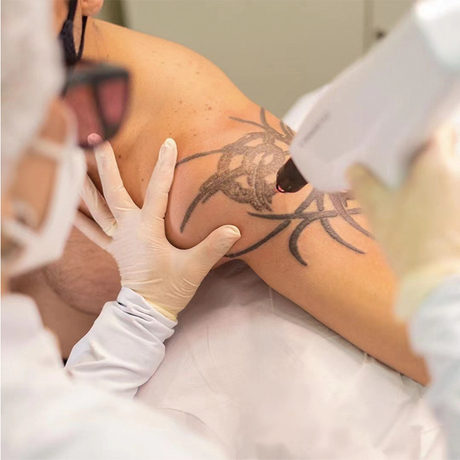 tattoo treatment.jpg