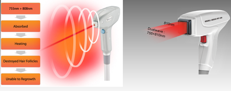 diode laser equipment