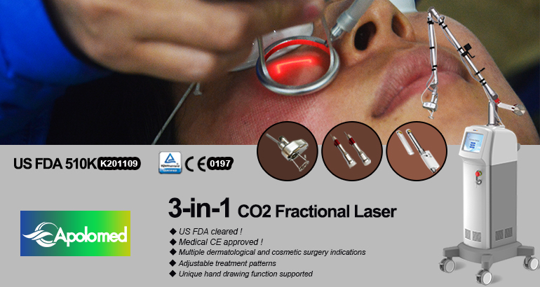 fractional C02 laser