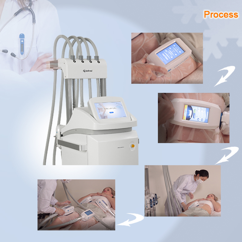 Cryolipolysis Body Slimming HS-580