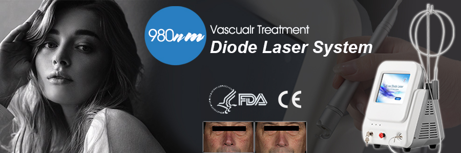 vascular removal 980nm diode laser device