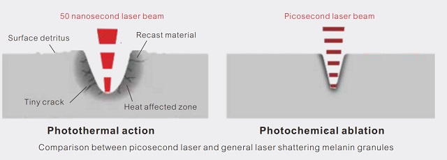 picosecond laser principle