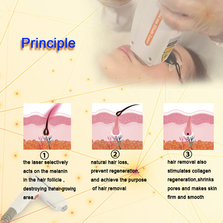 What is Diode laser machine  Treatment Procedures, Conditions Treated,  Benefits of Diode laser machine - SkinGenious.