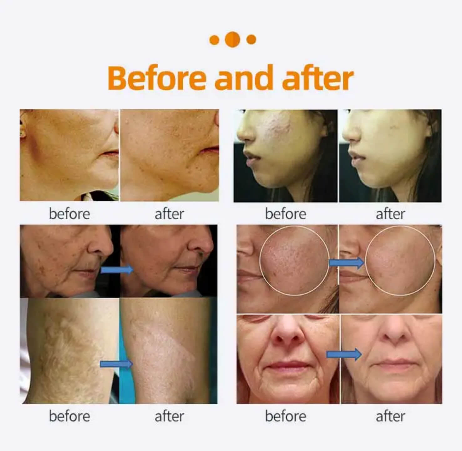 Before&After
